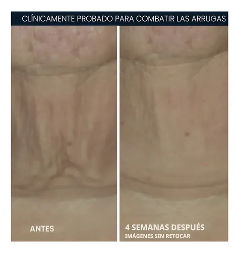 Roc-derm Correxion/retinol Y Antioxidantes/reafirma En Barra