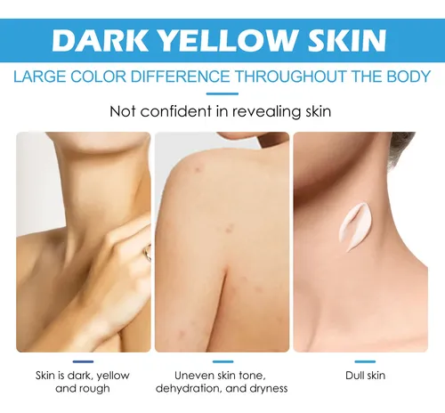 Crema De Manos Iluminadora Eelhoe Para Piel Seca Y Agrietada