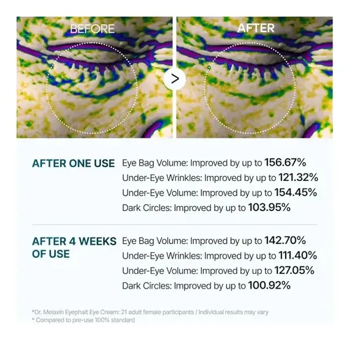 Aadr. Melaxin Crema Contorno De Ojos Bolsas Y Ojeras – .ss