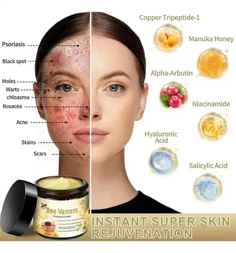 A Crema De Tratamiento Para La Piel De Abeja Pj //hy, All A