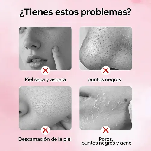 Gel Exfoliante Blanqueador Limpieza Profunda Reducción 5pcs