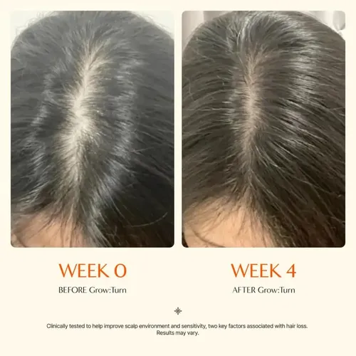 – Hdyl Wzklr .js Lilyeve Growturn Serum Capilar Con Ll