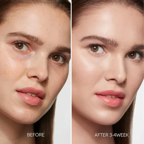 Eliminador De Manchas Oscuras Para Rostro Y Cuerpo – Sérum