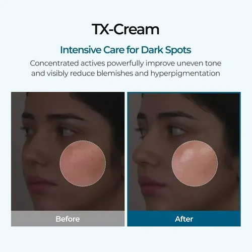 Crema Acido Tranexámico+ Niacinamida Reduz Manchas 50ml Dfbd