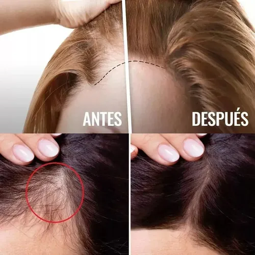 Serum Crecimiento Fortalecedor Engrosador Cabello Quvek 30ml