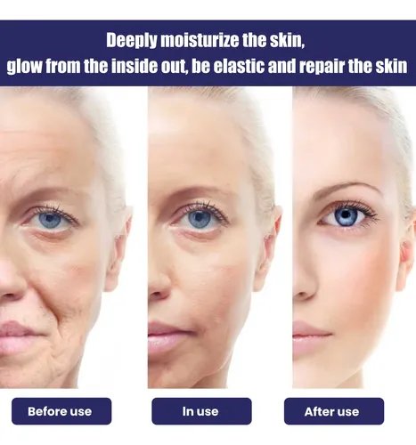 La Crema Facial Hidratante Ouhoe Reduce Las Manchas Y Las Lí