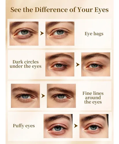 Parche Ojos Gold 24k Caffeine Collagen Con Ácido