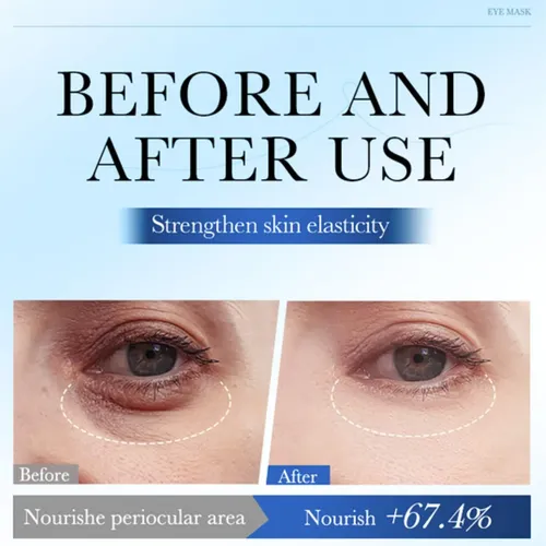 .parches Oculares De Microagujas Para Ojeras, Ojos/