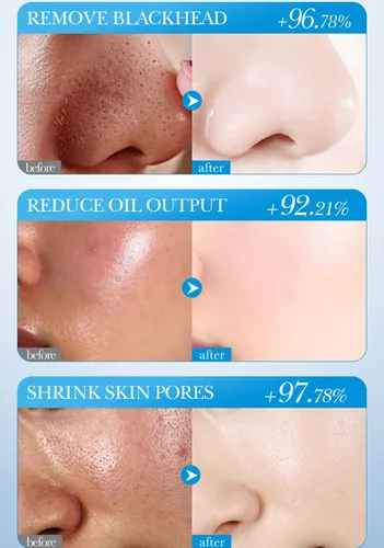 Mascarilla De Barro Facial Limpiadora En Barra Marine Firmin Todo Tipo De Piel