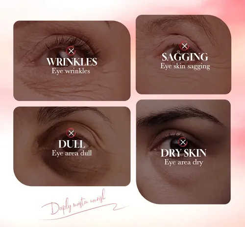Crema De Ojos De Melocotón: Iluminadora Y Nutritiva Para Ojo
