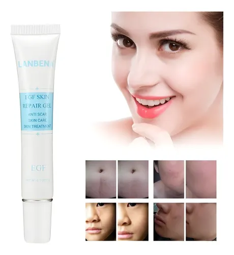 Crema Facial Blanqueador Acne Cicatriz No Cicatricure Import