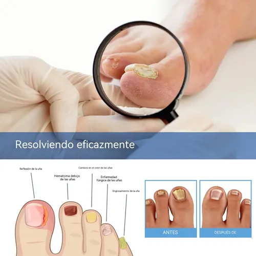Parche Para El Cuidado De Las Uñas, Suave Y Limpio, Transpir 60 Patches As Described
