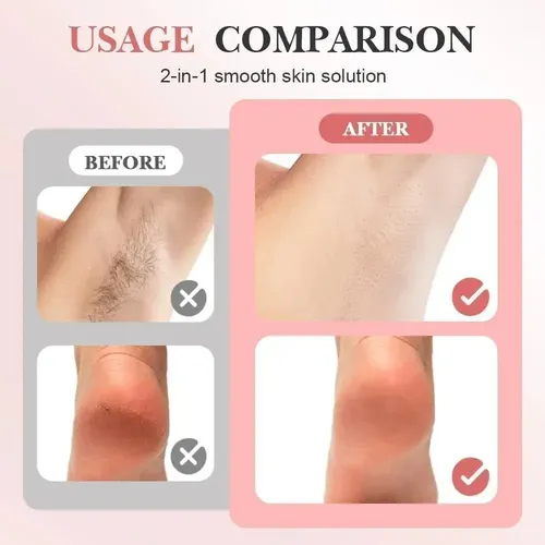 Depiladora Magica Y Exfoliador De Pies 2 En 1 Electrica