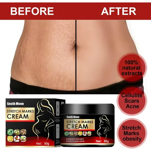 Crema Para El Cuidado De La Piel Para Mujeres, Humectante Pa 30g Boxed