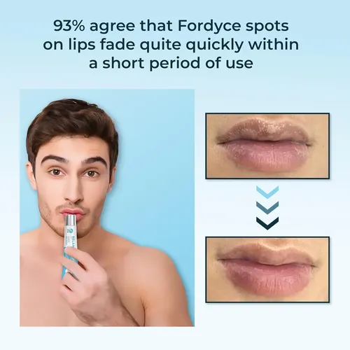 / Ss D Crema Fordyce, Mejora La Sequedad, Máscara De Labios