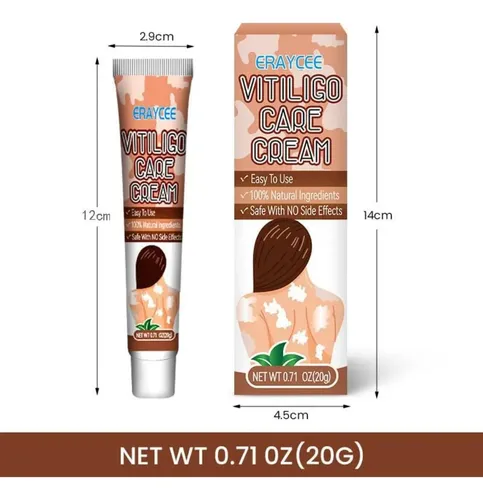 M* Crema Para El Vitíligo Para Reducir Las Manchas *xl