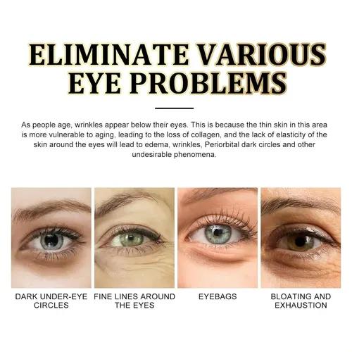 Parche Ocular De Ácido Hialurónico (elimina Ojeras, Bolsas E