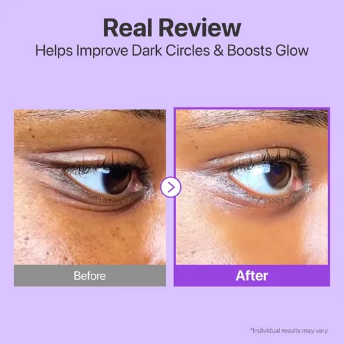 Bbcrema De Ojos Ssnumbuzin Con Retinol Hhff R