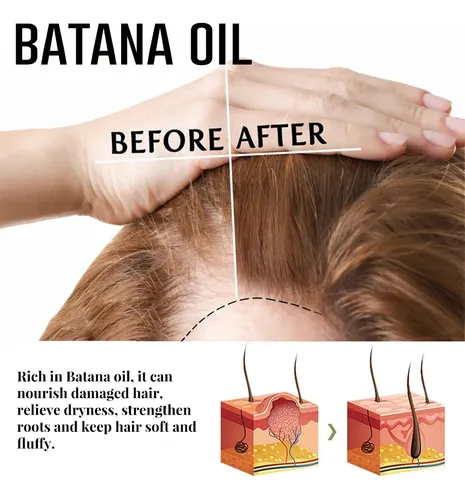Spray Para El Cabello Batana Oil Boost, 30 Ml, Más Denso, Más Sal