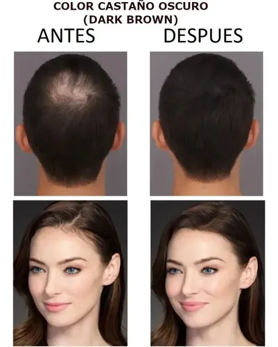 Fibras Capilares Castaño Medio Glowex 27,5g Calvicie Grosor Volumen