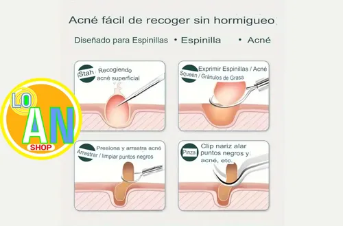 Limpieza Facial Kit Puntos Negros Rodillo Jade 3 Mascaras
