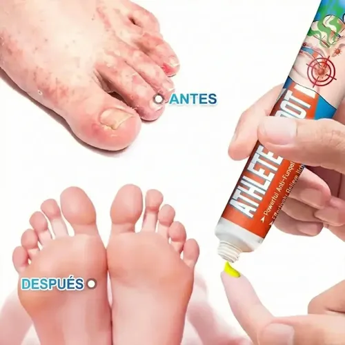 Crema Piel Pie Atleta Alivio Prolongado Picazón Uso Diario