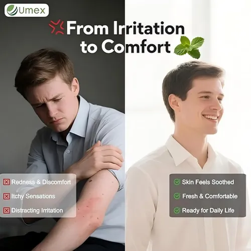 Cccrema Umex Intensiva Para Alivio De Picazón 60g Hidratante