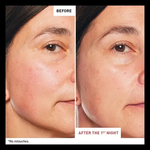 Erborian Skin Therapy Aceite Y Sérum Nocturno 10 Ml