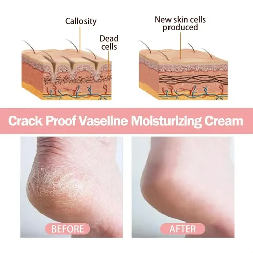 Crema Hidratante Gel Exfoliante Para Pies Y Manos Fd