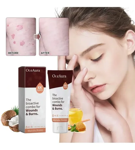Hy./ La Crema Reparadora De Piel Oceaura Alivia El