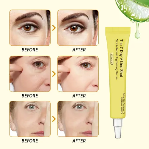 Aclarador Hidratante S Eyes Refrescante Aces Brass E