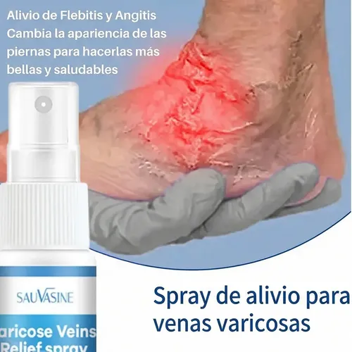 Spray Piel Piernas Cansadas Varicosas Estrías Natural Ligera