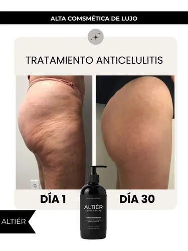 Crema Corporal Altiér Anti-celulitis Piernas Relajadas 230ml Neutra