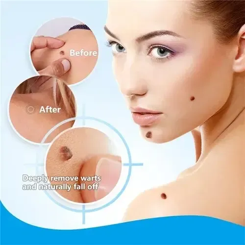 Crema Eliminadora De Manchas Instantánea, 2 Unidades . P&