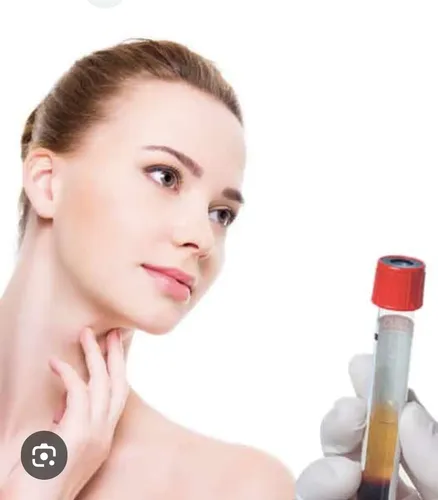Plasma Rico En Plaquetas! Facial!!!!