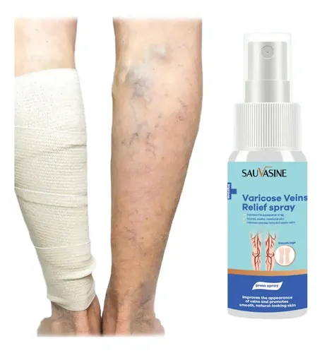 Spray Piel Piernas Cansadas Varicosas Estrías Natural Ligera