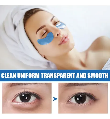 Tratamiento De Ojeras Con Colágeno
