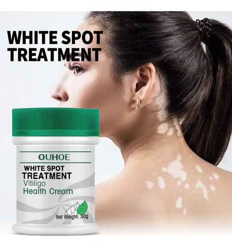 La Crema Reparadora De Manchas Blancas Ouhoe Repara Y Aclara