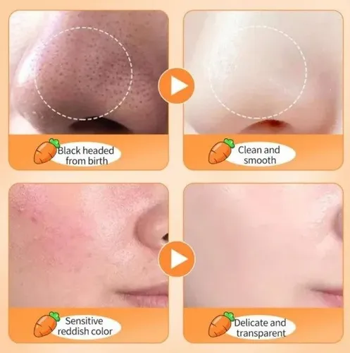 Mascarilla Facial De Zanahoria Espuma X12 Und Sadoer