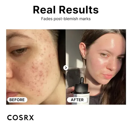 The Niacinamide 15 Serum – Cosrx Momento de aplicación Día/Noche Tipo de piel Todo tipo de piel