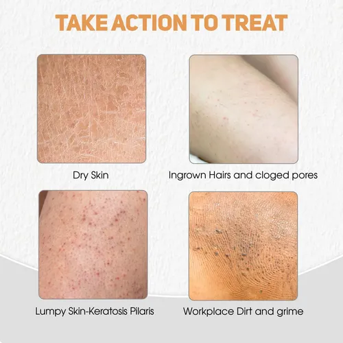 Guante Exfoliante Corporal Autobronceador Y Tratamiento Vell