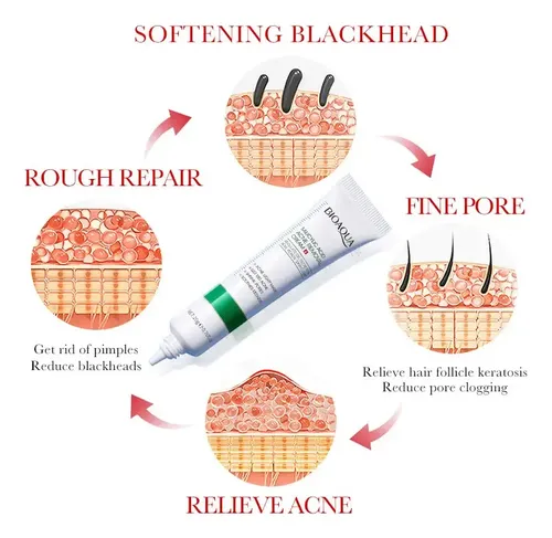 *(|f@ A Td Crema Para Eliminar El Acné Salicílico Bioaqua El