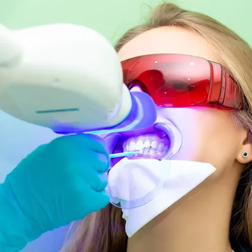 Funda Dental Flexible y Dentadura Cosmética Provisoria para Sonrisa Perfecta