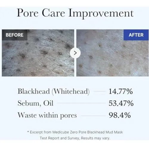 Medicare Zero Pore Mud Mask Set Con Brocha 4 En 1