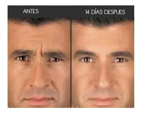 Reparador Intensivo De Ojeras Idraet Sublime Eyes Peptides