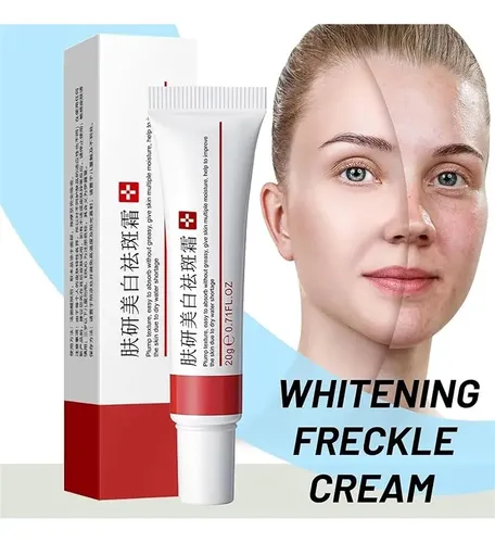 Crema Para Manchas Oscuras En La Cara, Cremas Para Quitar
