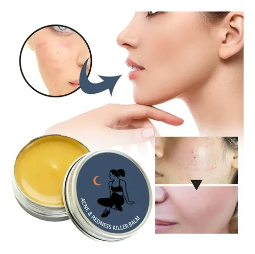 Bálsamo Para El Cuidado De La Piel Facial, Acné Y Enrojecimi