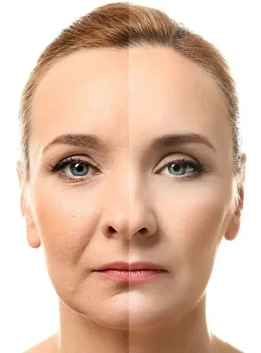 Carthage Crema Facial Lipo Lifting Tensora Anti Age