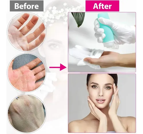 Guantes Algodón Blancos Medianos Para Manos Secas Eccema