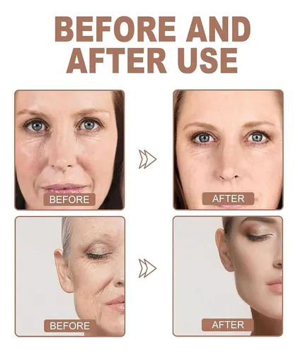 Bnn Crema Facial Con Vitamina C Carvenchyb